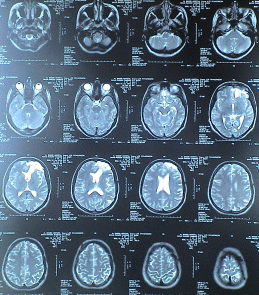 T2W transverse sections