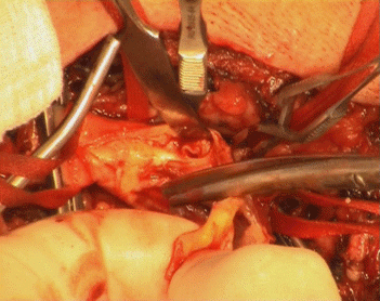 Further cleaning of the debris after removal of the mess.